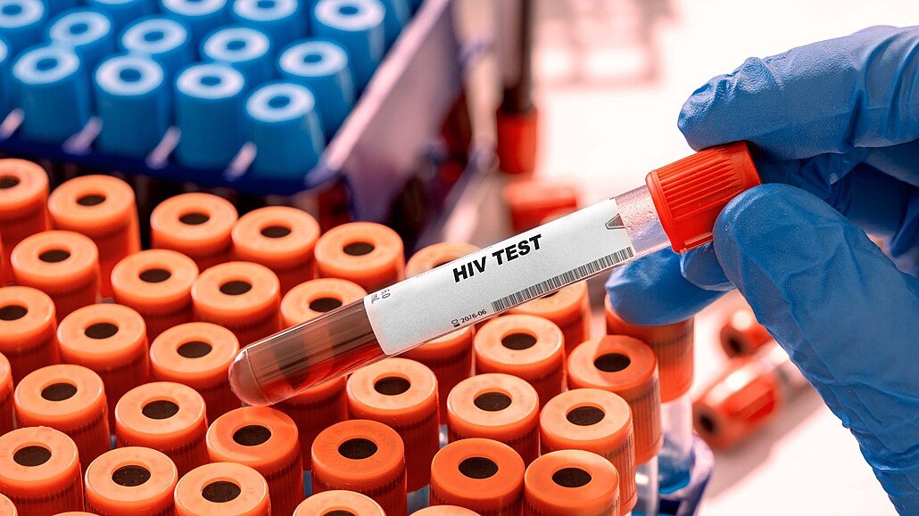 HIV v Česku dál přibývá. Případy nejsou jen ve velkých městech, týkají se i Prahy a Středočeského kraje