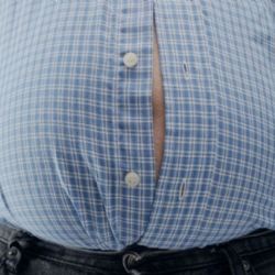 Děčínská nemocnice získala akreditaci pro bariatrickou chirurgii