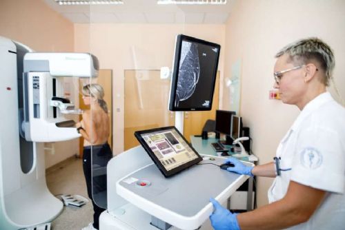 obrázek:Klientky VZP budou moci od července na mamografii i bez žádanky