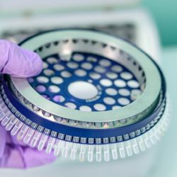 Praha 7 se zapojí do pilotního projektu PCR pooling testování s cílem bezpečně vrátit všechny děti do škol